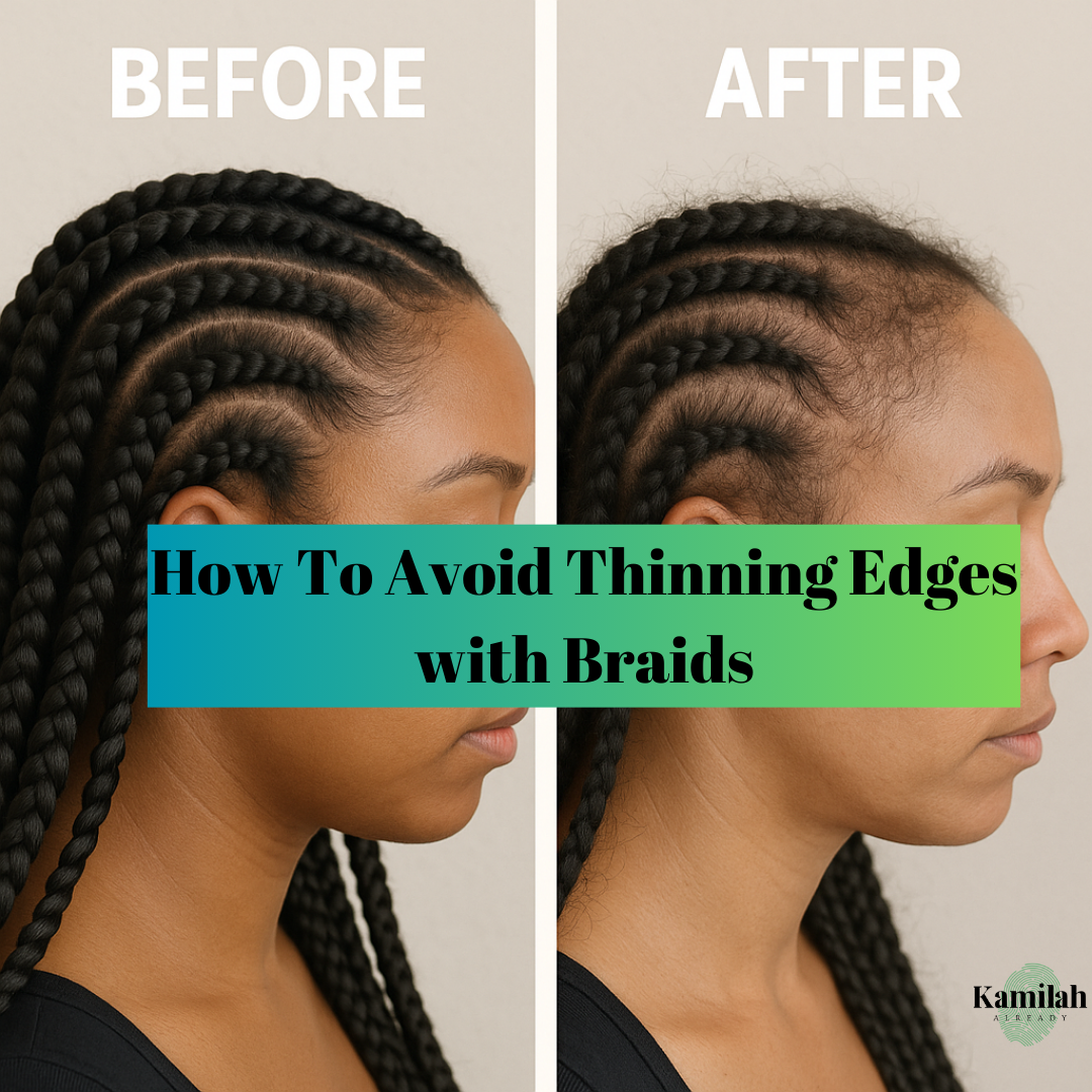 How To Avoid Thinning Edges with Braids: Protect Your Hairline Without Sacrificing Style