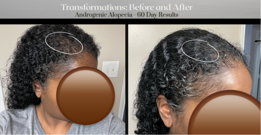 Edge Back Hair Serum (3 Month Supply) + Travel Bag