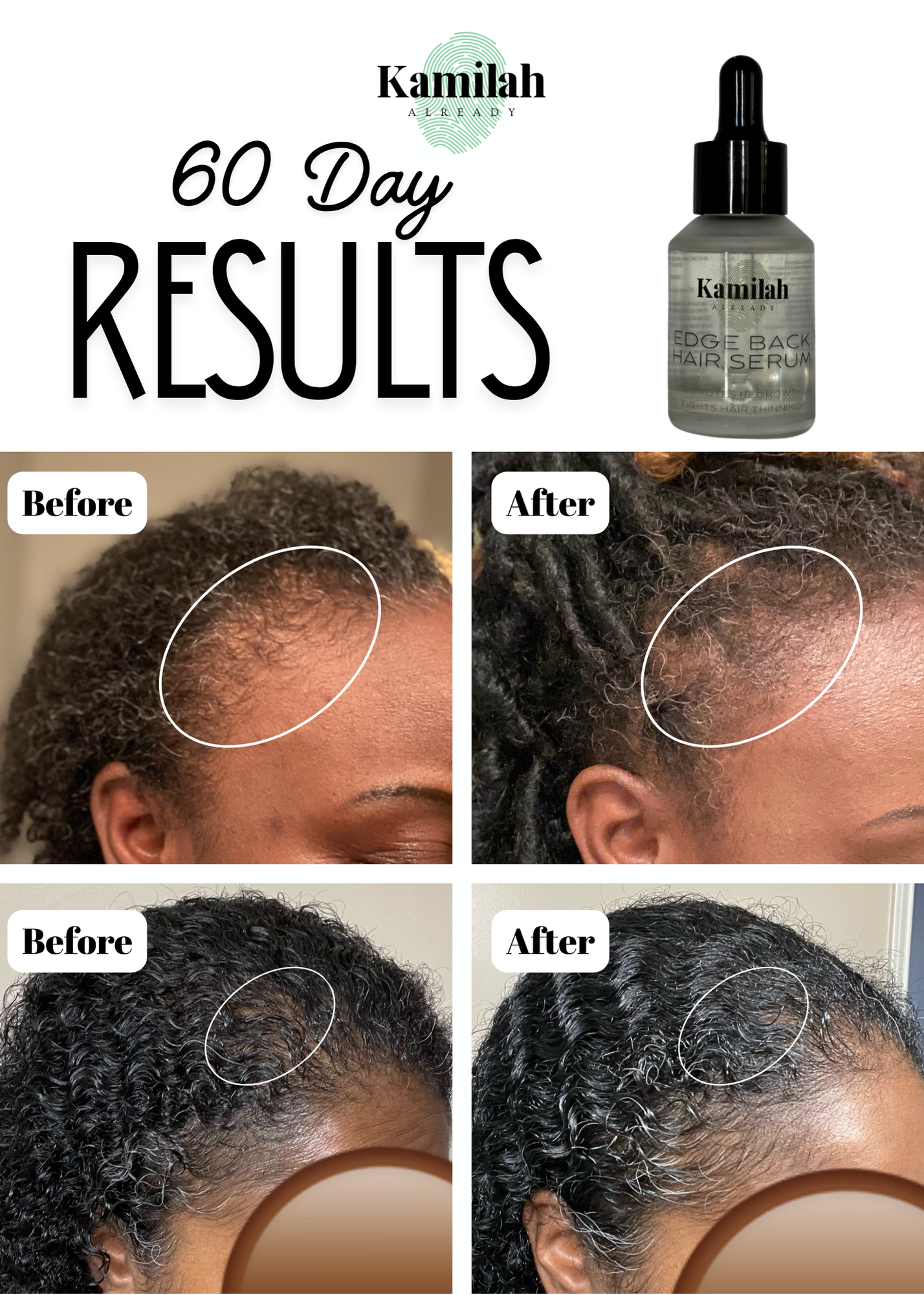 Edge Back Hair Serum